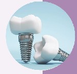 Центр имплантации и стоматологии «Стеллит» осуществляет широкий комплекс стоматологических услуг в Санкт-Петербурге.  Наши основные направления деятельности:  
- имплантация зубов;  
- терапия и леч ...