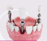 Стоматология Dental Luxury Clinic осуществляет широкий спектр стоматологических услуг в Москве.  Наши клиники оснащены ультрасовременным оборудованием.  Основные услуги:  
- лечение зубов под общей а ...